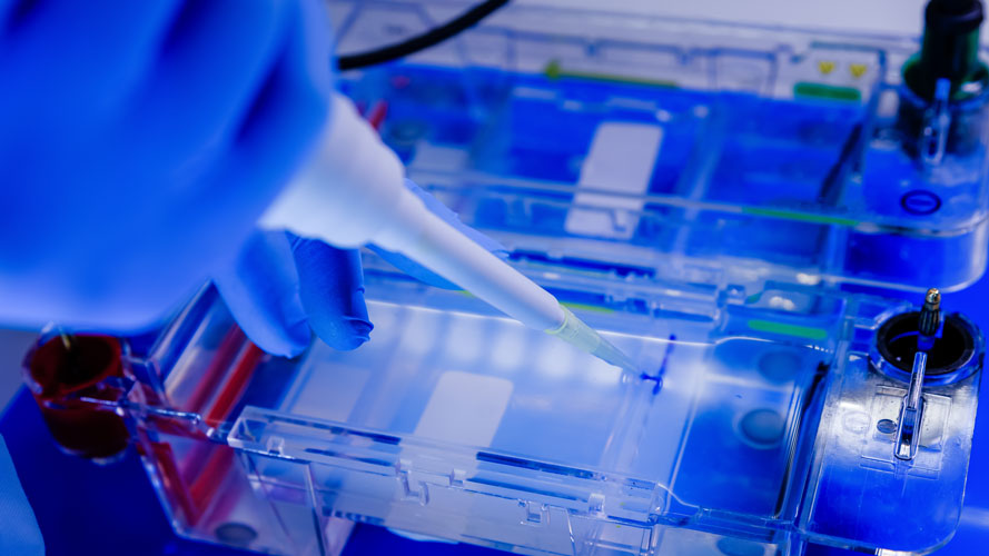 electrophoresis process